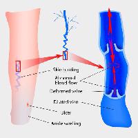 Pixwords изображение с кожи, нога, ноги, лодыжки, кровь, стрелки, медицинские, медицина Designua